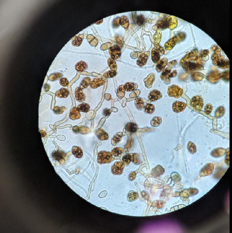 Ulocladium under the Microscope