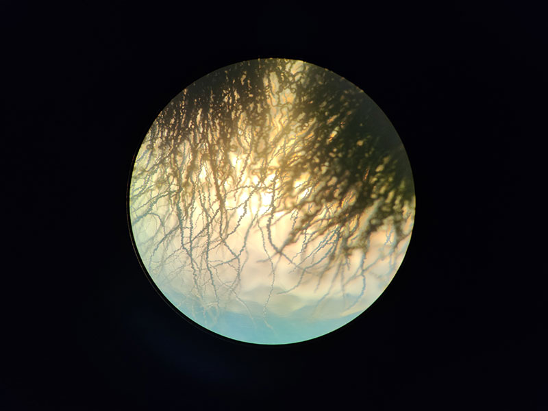 Aureobasidium Microscope View